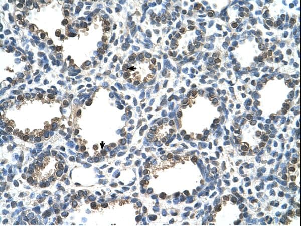 RAD23A / HHR23A Antibody (aa141-190)