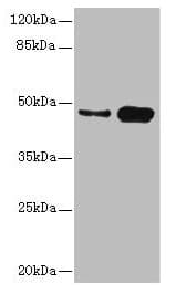 Polyclonal Rabbit anti-Human CSNK1G2 / CKI-Gamma 2 Antibody (IHC, WB)