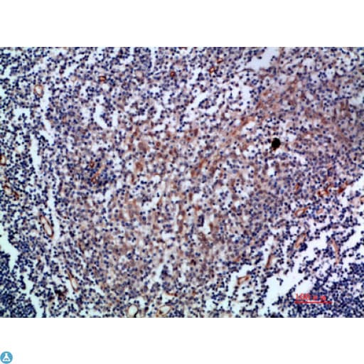 CD105 Antibody