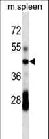 CD79A / CD79 Alpha Antibody (aa160-188)