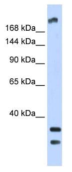 TRPM2 Antibody (aa431-480)