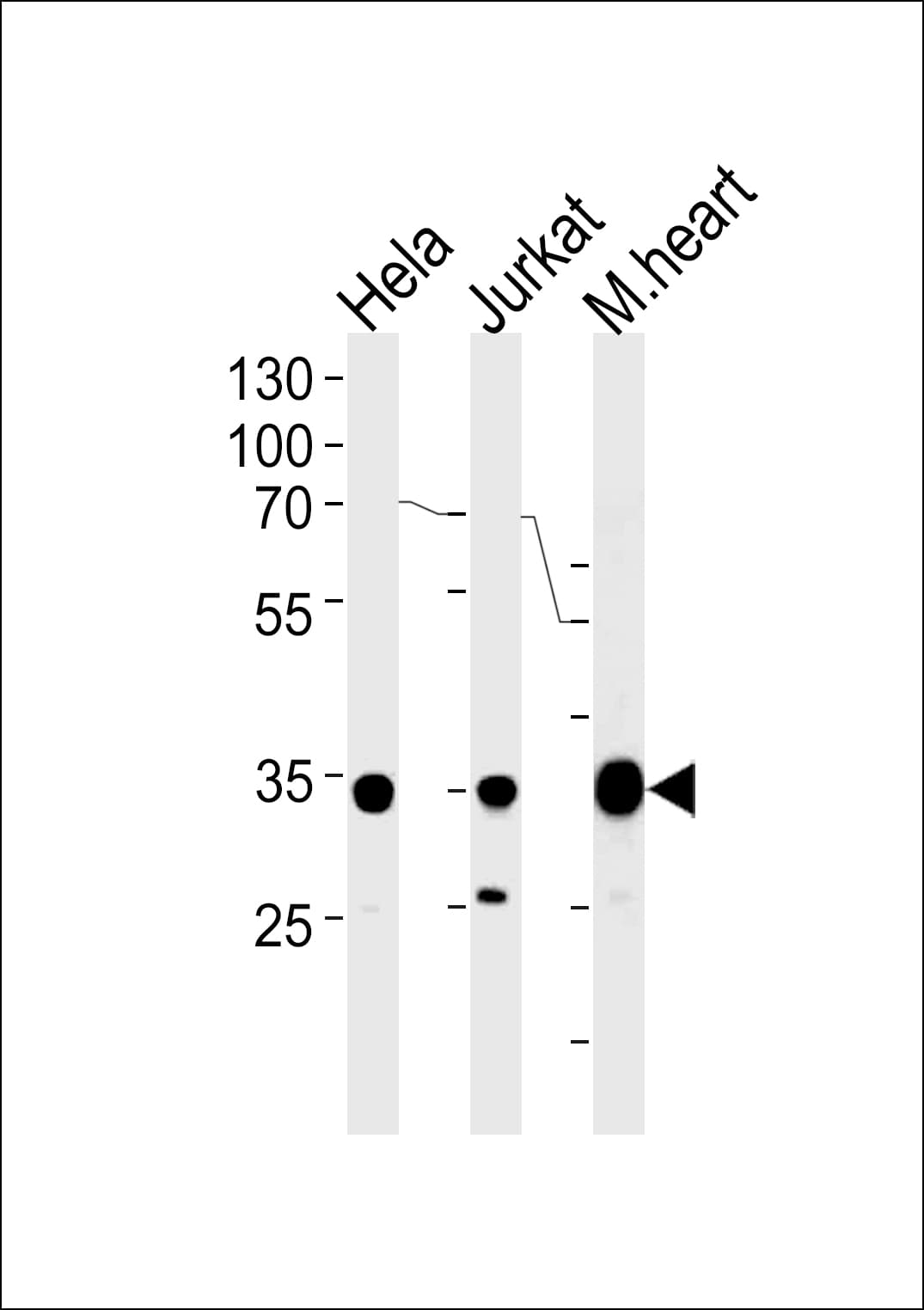 Polyclonal Rabbit anti-Human NDUFA9 Antibody (aa99-121, WB)