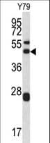 ARPC1A Antibody (aa157-184)