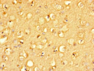 Polyclonal Rabbit anti-Human MANBAL Antibody