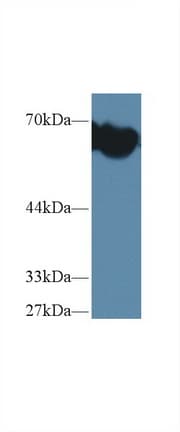 Alpha-Fetoprotein Antibody (aa399-605, Biotin)