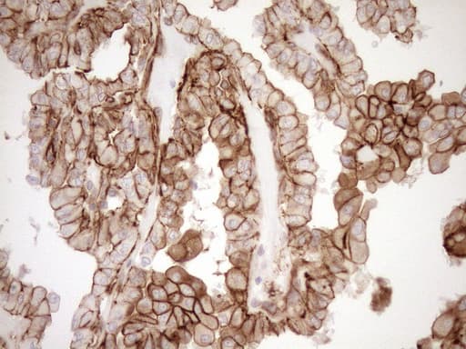 Monoclonal Mouse anti-Human EPLIN Antibody (clone OTI9F3, aa1-275, IHC, WB)
