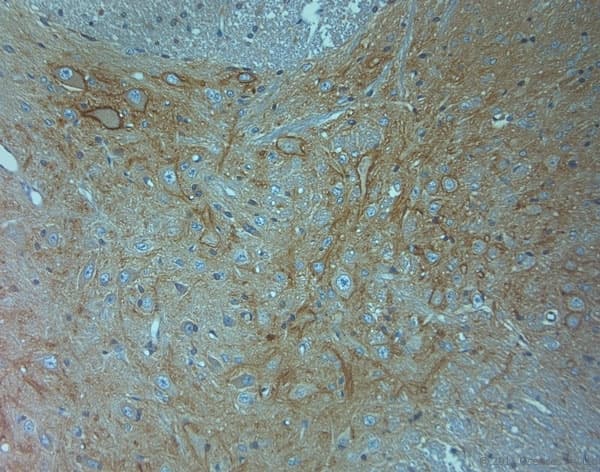 Polyclonal Rabbit anti-Human ACAN / Aggrecan Antibody (aa200-250, IHC)