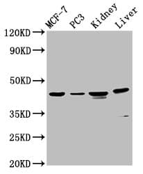HPN / TMPRSS1 / Hepsin Antibody