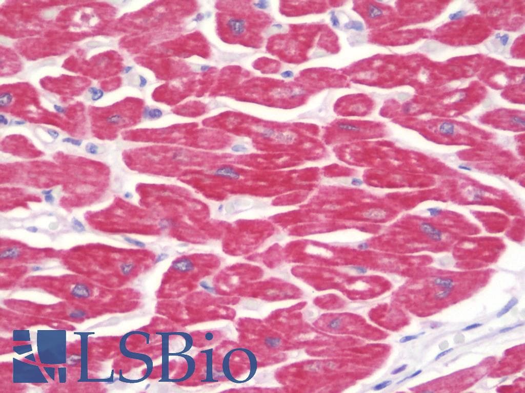 IHC-plus™ MYOM2 / Myomesin 2 Antibody (aa612-661)