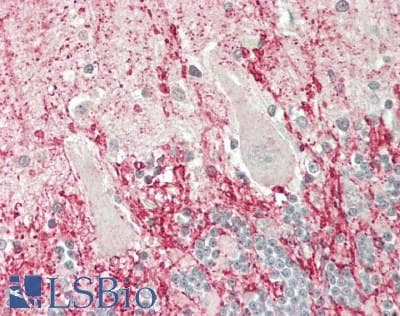 IHC-plus™ Polyclonal Rabbit anti-Human SLCO4A1 / OATP1 Antibody (aa672-722, IHC, WB)
