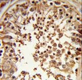 DMC1 Antibody (aa1-30)