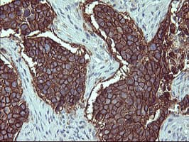 IL1A / IL-1 Alpha Antibody (clone OTI2F8)