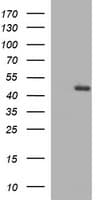TGFB1 / TGF Beta 1 Antibody (clone OTI2B5)