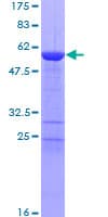 Human TPM1 / Tropomyosin Protein (Recombinant GST)