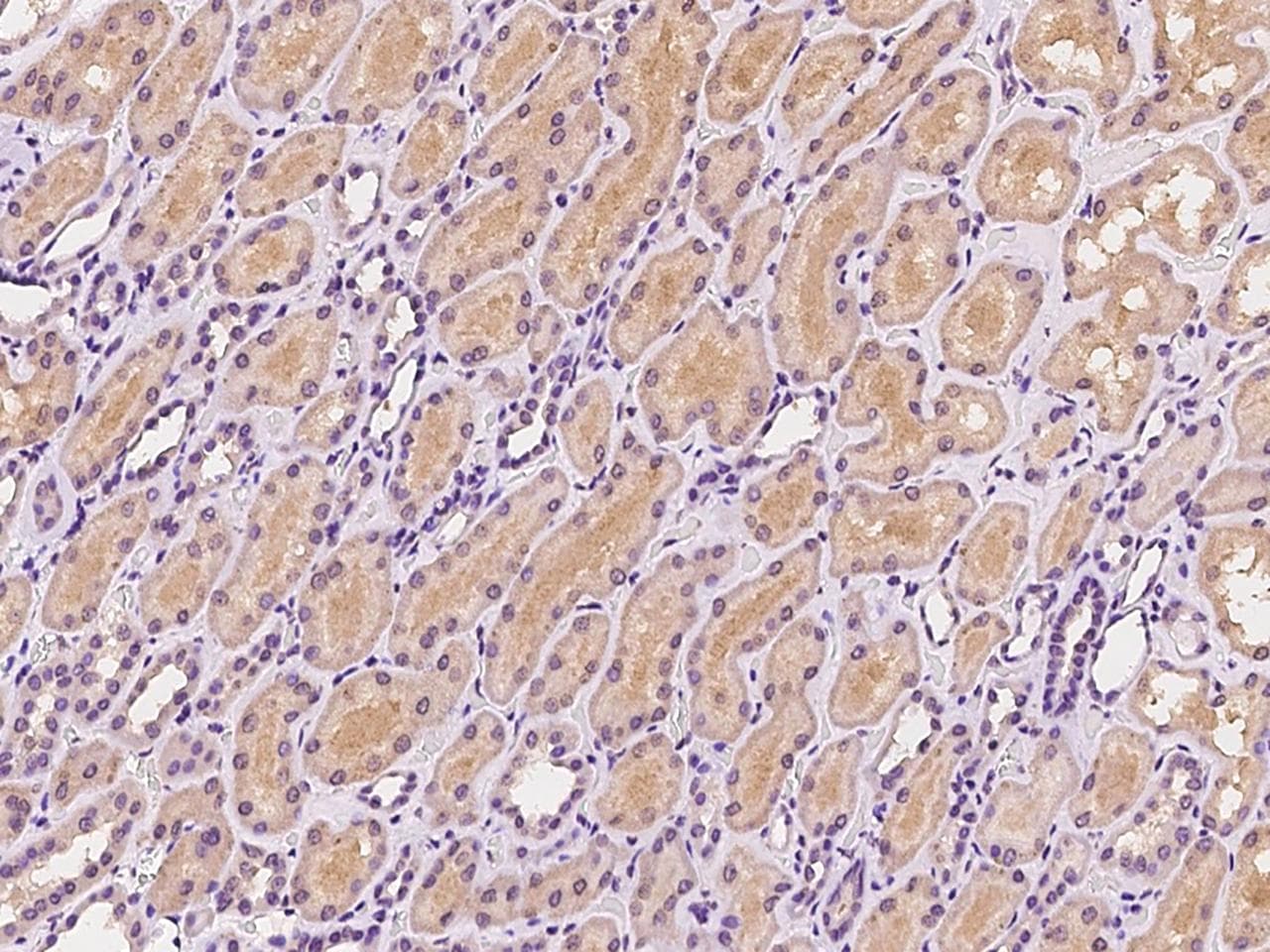 Polyclonal Rabbit anti-Human SNX3 Antibody (IHC, IF, WB)