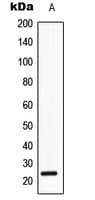 Polyclonal Rabbit anti-Human SRY Antibody (Internal, IHC, WB)