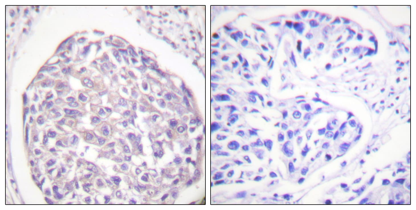 Polyclonal Rabbit anti-Human INSR / Insulin Receptor Antibody (phospho-Tyr1355, IHC, WB)