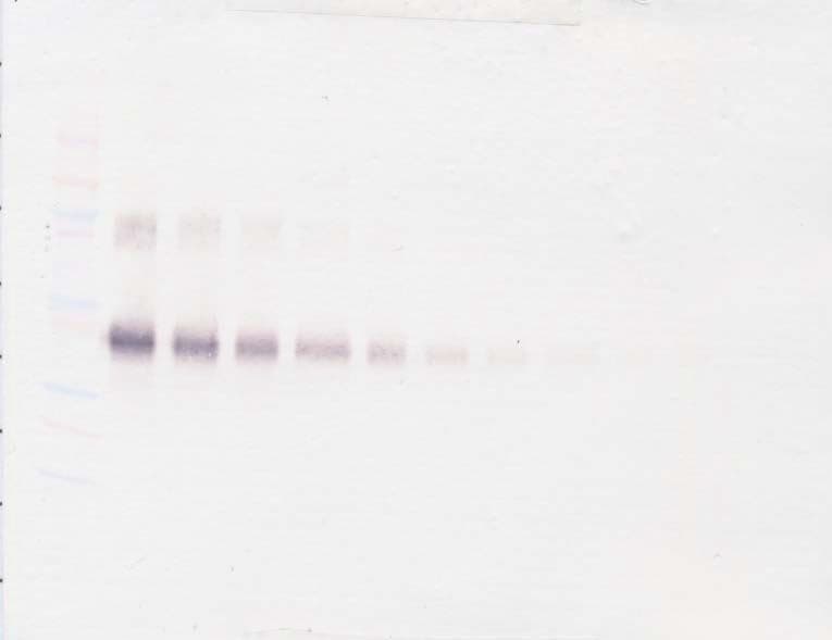 IL2RA / CD25 Antibody