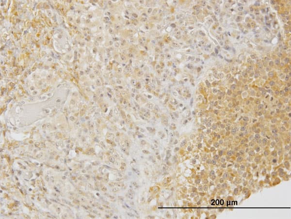 DPYSL3 / CRMP4 Antibody (clone 1B8)