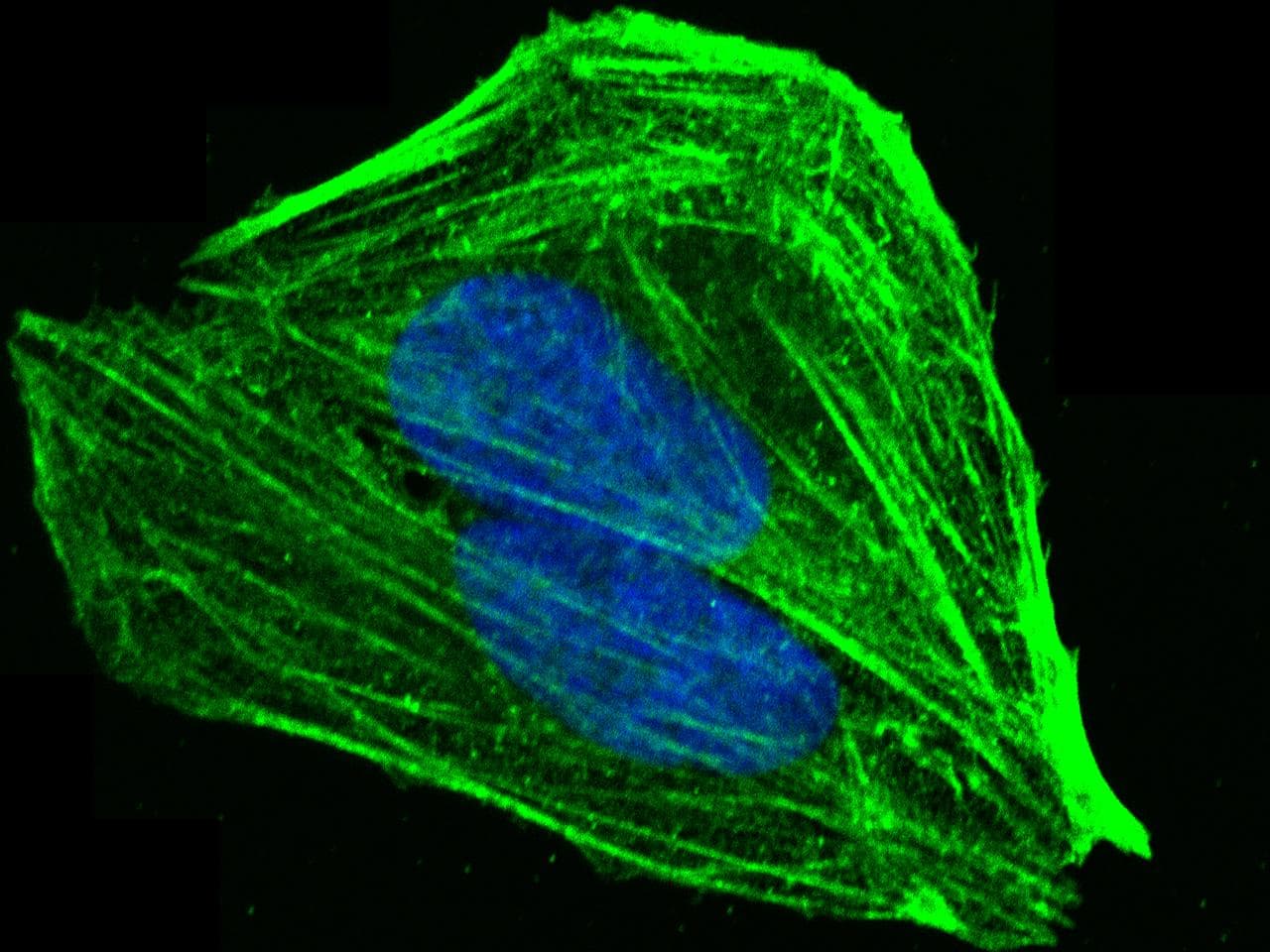 Polyclonal Rabbit anti-Human LCP1 / L-Plastin Antibody (Preservative Free, IF, WB)
