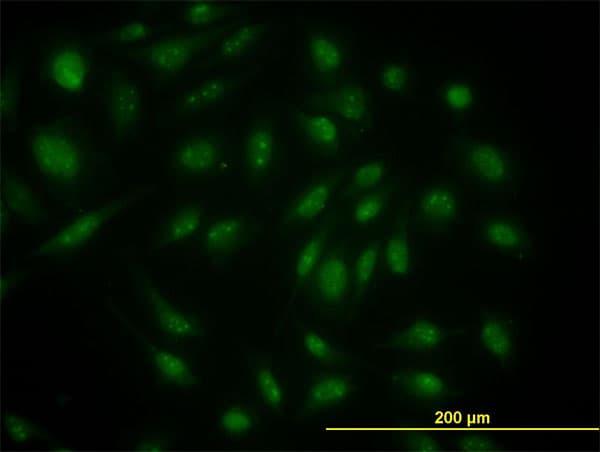 SKP1 Antibody (clone 1H8)