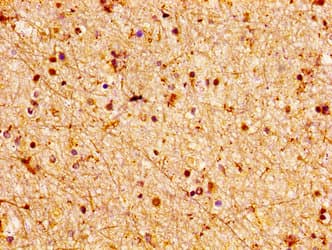 Polyclonal Rabbit anti-Human LGI2 Antibody (IHC)