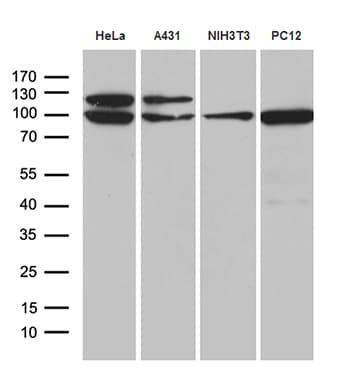 KPNB1 / Importin Beta Antibody (aa1-200, clone OTI9D6)
