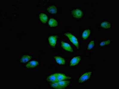 PTK2B / PYK2 Antibody