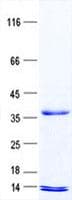 Human BM022 / MRPL1 Protein (Recombinant His, N-Terminal)