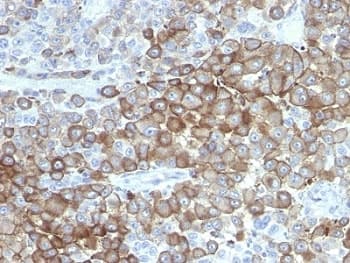 Melanoma Antibody (clone PNL2)