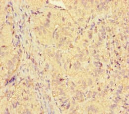 Polyclonal Rabbit anti-Human ICE1 Antibody (IHC, WB)