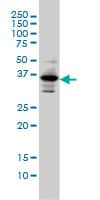 Monoclonal Mouse anti-Human PITX1 Antibody (clone 5G4, WB)