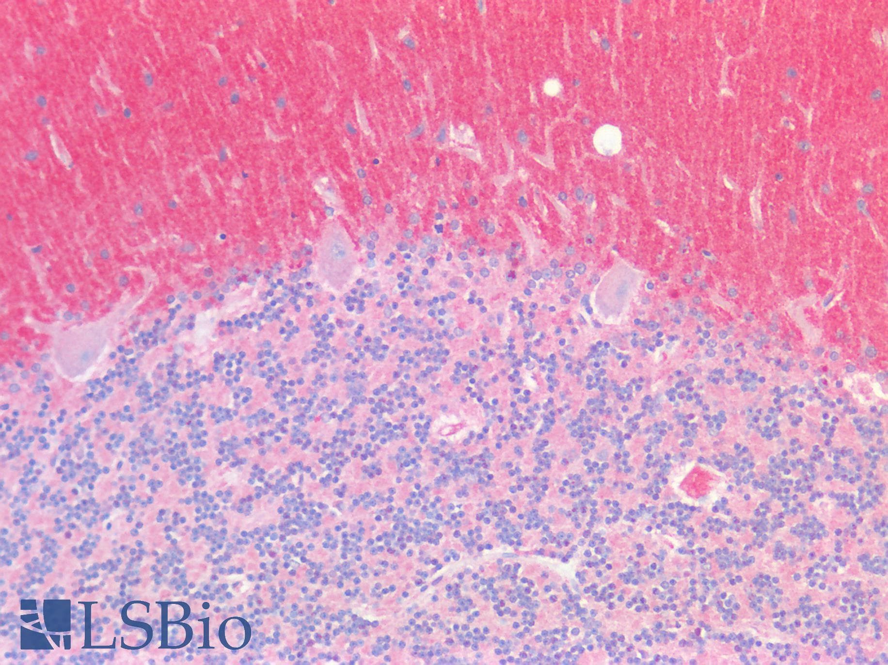 PathPlus™ SERPINB7 / MEGSIN Antibody (aa98-147)