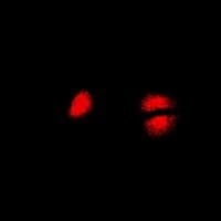 PCBD1 / PHS Antibody