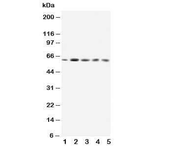 GRB7 Antibody (aa124-141)