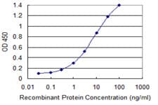 Monoclonal Mouse anti-Human FBXL3 Antibody (clone 1A3, WB)