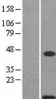 Calgizzarin / S100A11 Protein (Over-Expression Lysate Myc-DDK (Flag))