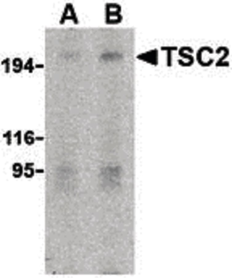 IHC-plus™ Polyclonal Rabbit anti-Human Tuberin / TSC2 Antibody (IHC, IF, WB)