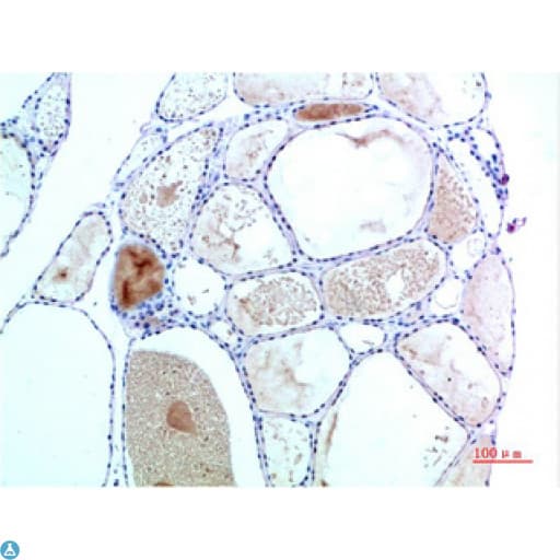 TTR / Transthyretin Antibody