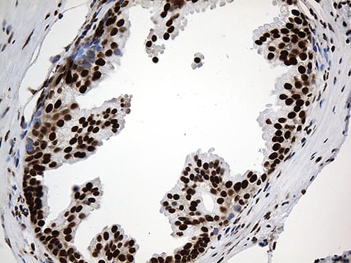 Monoclonal Mouse anti-Human PTBP3 / ROD1 Antibody (clone OTI5G7, aa300-552, IHC, WB)