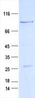Human FOXC1 Protein (Recombinant GST, N-terminus + His, C-terminus)