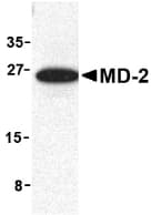 Polyclonal Rabbit anti-Human LY96 / MD2 / MD-2 Antibody (IHC, IF, WB)