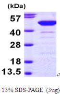 Human NCF1 / p47phox / p47 phox Protein (Recombinant His)