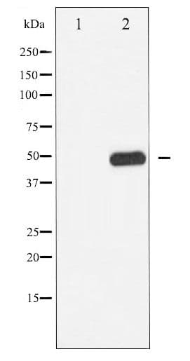 CAMK2 / CAMKII Antibody (phospho-Thr286)