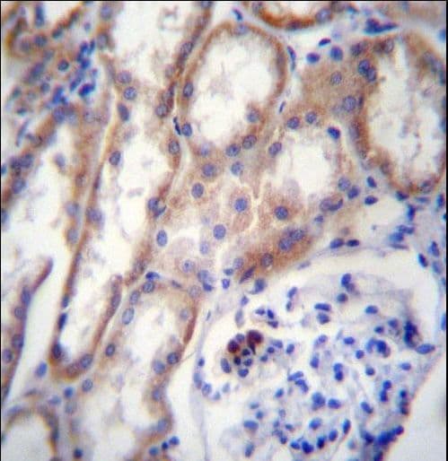 Polyclonal Rabbit anti-Human ZP4 / ZBP Antibody (aa445-474, IHC, WB)