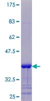 Human SPRR4 Protein (Recombinant GST)
