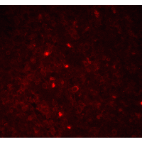 IHC-plus™ PYCARD / ASC / TMS1 Antibody