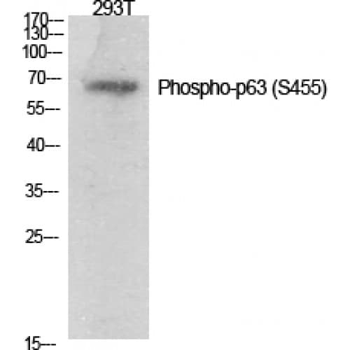 AMACR / P504S Antibody (390-470 aa)