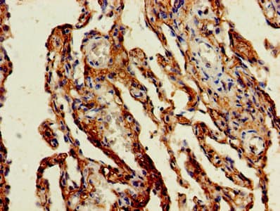 Polyclonal Rabbit anti-Human CR6 / GADD45G Antibody (aa1-159)