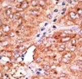 ACKR2 / CCR10 / D6 Antibody (aa298-328)